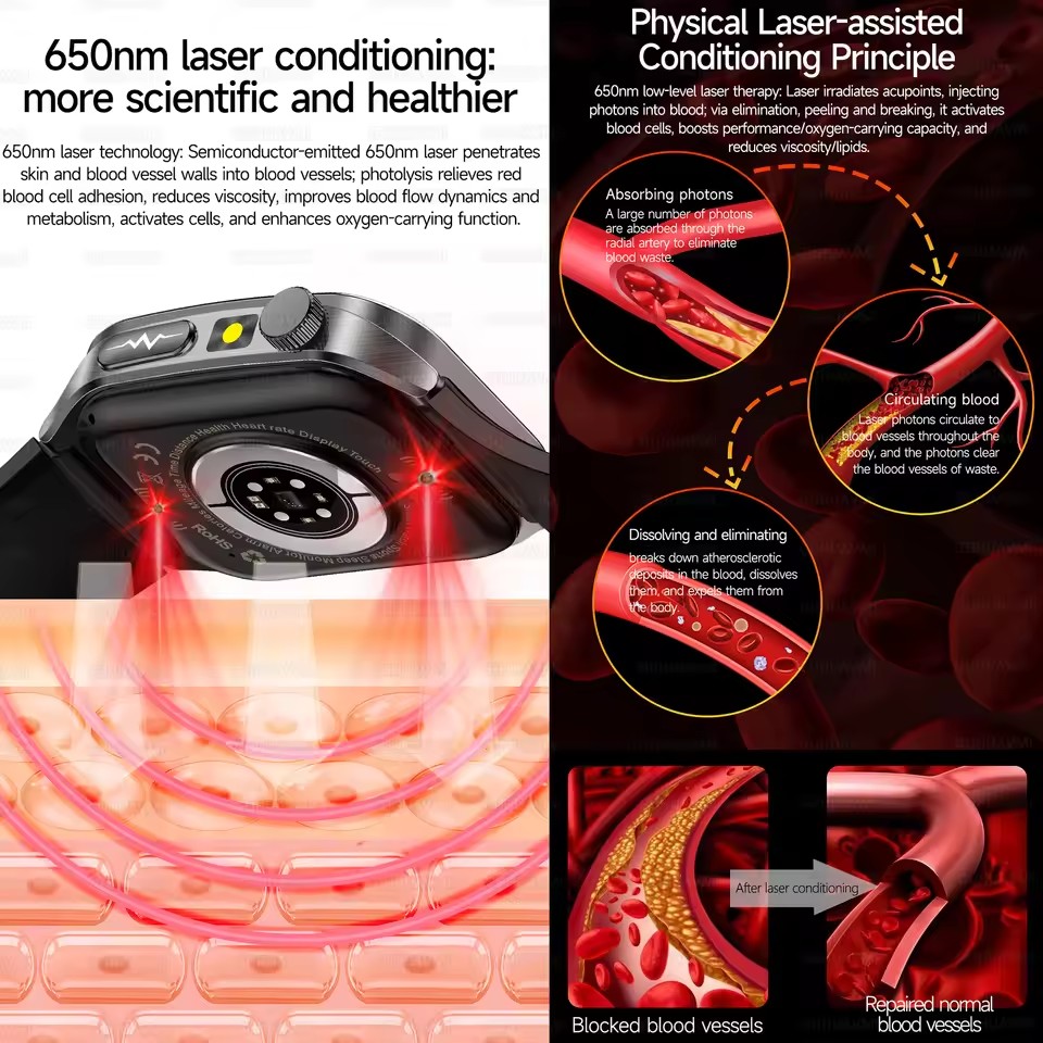 2026년 신형 헬스 스마트워치 레이저 치료로 고혈압, - Laser Distance Measure 리뷰 및 가격